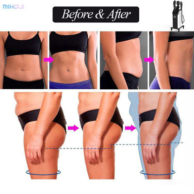 Buy peface Beauty 5 In 1 Body Slimming Machine 4 Handles With 3600VA Power Consumption online manufacture