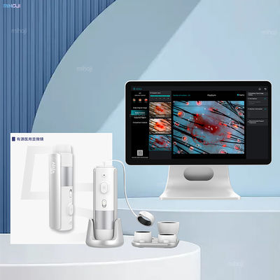 Buy Handheld High Definition Hair Analyzer Machine For Hair Follicles Clogged online manufacture